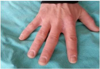 Figure 6: Postoperative second year image.