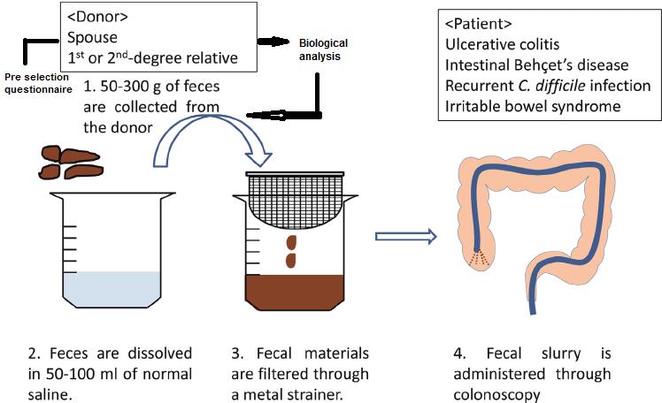 Figure 1: Stool transplantation procedure.