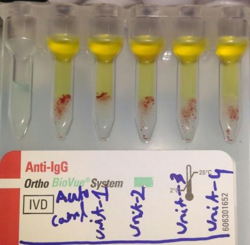 Figure 2: Best match blood transfusion based on reaction strength with autocontrol.