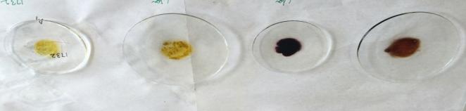 Figure 2: Showing marquis test and frohde’s test.