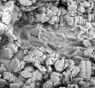 Figure 12: SEM images of sandstone recovered from BH(A)(depth=3827-3837m) showing Kaolinite books.