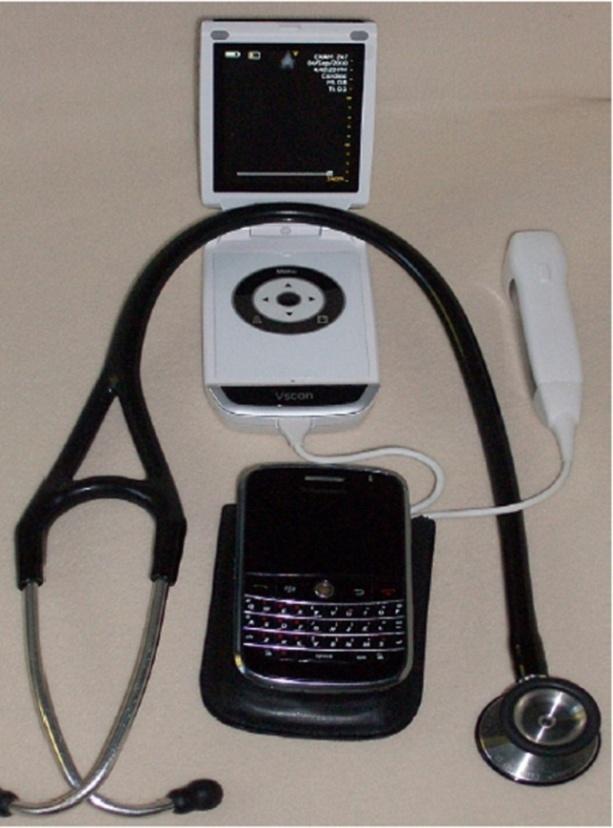 Figure 1: GE V-Scan (weight 390 g, General Electric, Milwaukee, WI, USA) with ﬁxed sector angle of 75º and a 1.7- 3.8MHz transducer.