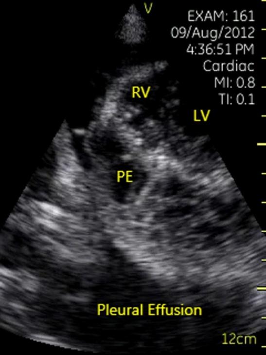 Figure 14