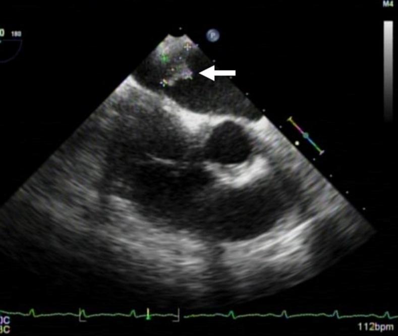 Figure 15