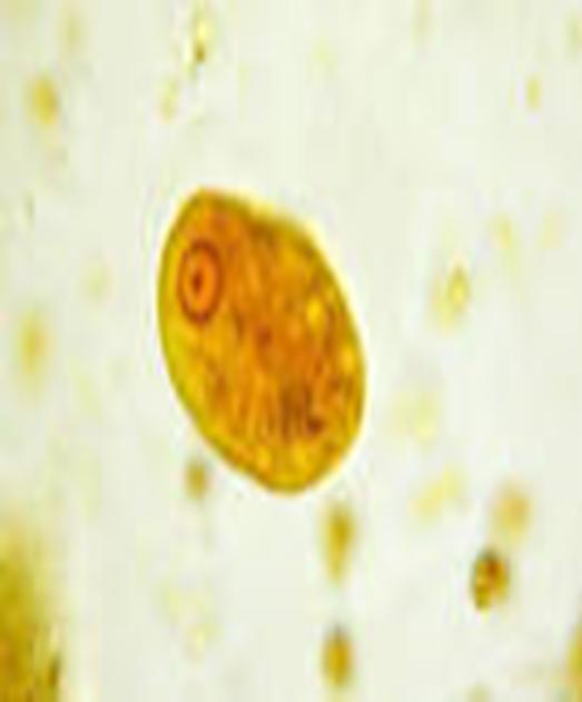 Figure 2: Trophozoite of Entamoeba coli, stained with iodine.