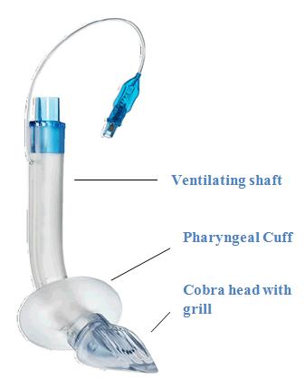Figure 6: Cobra per laryngeal airway.