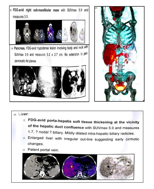 Figure 1: Endoscopic retrograde cholangiopancreatography (ERCP).