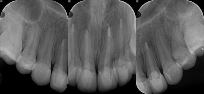Figure 11: Post-operative radiographs.