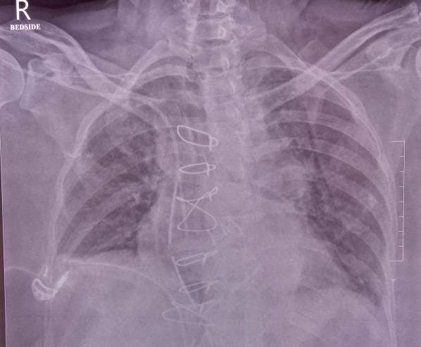 Figure 3: After correct placement.