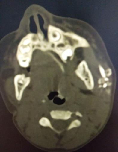 Figure 2: Parotid area.