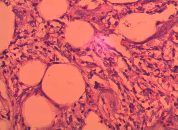 Figure 4: Picture of photomicrograph of the histology.