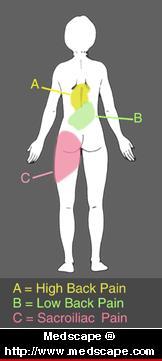 Figure 1: Low back pain diagram