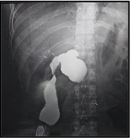 Figure 5: Surgical piece sectioned in block.