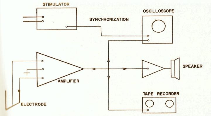 Figure 2: Basic potential are picked up by either a needle electrode or surface electrode and then amplified by amplifier. The output of amplifier is connected to different monitoring devices a) An oscilloscope to permit immediate display and visual monitoring of the potentials, b) An audio amplifier and speaker, to allow acoustic monitoring of the potential and c) A recorder- to make a permanent record of the displayed potentials. The recorder may be one of the several available magnetic tape, film or fiber optic photographic paper readout devices. Electromyography [9] is only reliable method available for the objective recording of a Patient’s muscular function. In clinical dentistry EMG is used primarily to evaluate patients with complaint of temporomandibular joint dysfunction, jaw muscle pain/dysfunction EMG study was done to evaluate changes takes place in muscle of mastication before and after giving ultrasound as therapeutic measure. EMG recording directly measures muscle activity.