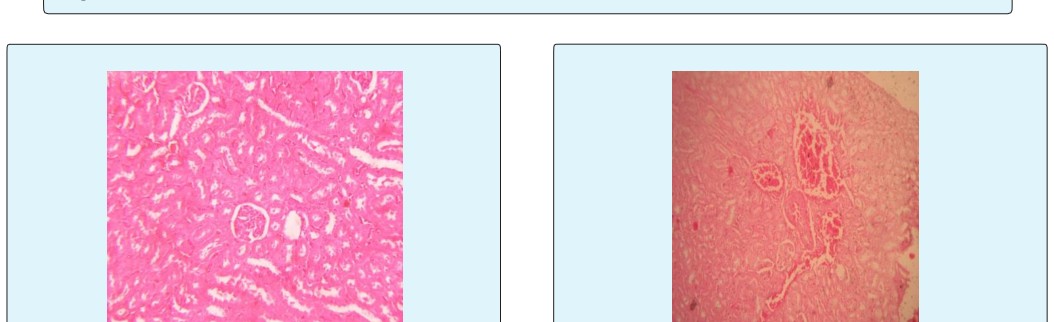 Figure 2: The effects of different doses of lithium carbonate alone or with L- ascorbic acid on serum creatinine.