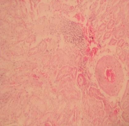Figure 3: The effects of different doses of lithium carbonate alone or with L- ascorbic acid on serum uric acid.