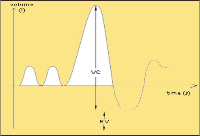 Figure 2: Predicting SVC.