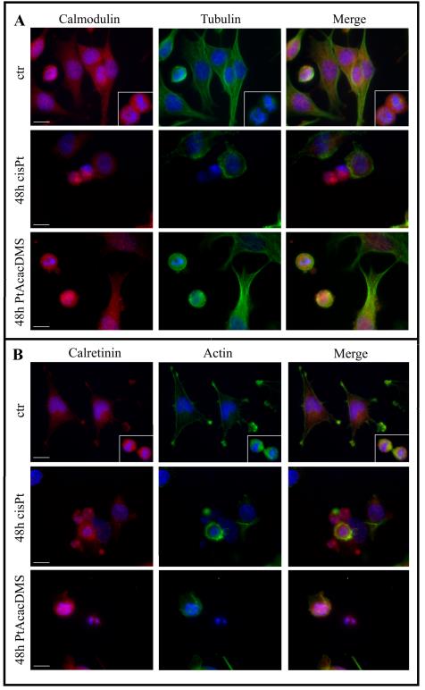 Figure 1: Double immunocytochemical detection in control (CTR) and in treated cells for 48 h at cisPt40 µM and PtacacDMS 10 µM: (A) CaM(red fluorescence) and α-Tubulin (green fluorescence); (B) CR (red fluorescence) and Actin (green fluorescence. DNA was counterstained with Hoechst 33258 (blue fluorescence). Bars: 20 µm. This analysis was conducted on B50 neuroblastoma rat cells cultured in Dulbecco’s Modified Eagle Medium (DMEM) supplemented with L-glutamine (2 mM), penicillin 100 IU ml-1, streptomycin (100 mg l-1) and 10% fetal bovine serum (FBS). Cell culture was carried out at 37°C in a 5% CO2 humidified chamber.