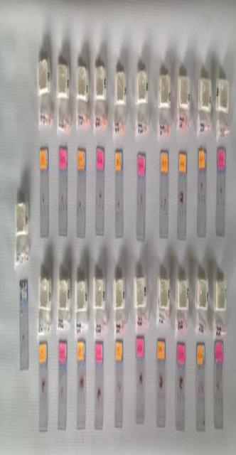 Figure 2: Preparation of the proximal and distal slices for evaluation.