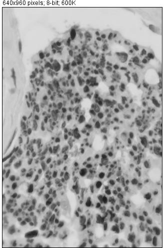 Figure 4: Peripheral nerve cut image converted to 8 bits.