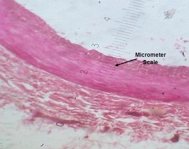 Figure 2: Showing Micrometer Scale.