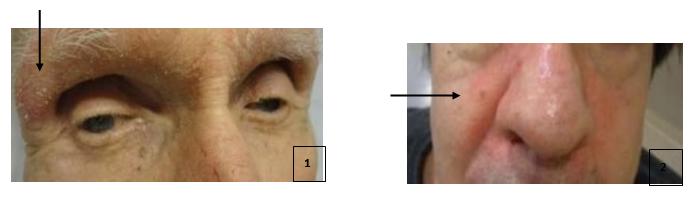 Figure 16: Examples of over the counter micronutrient skin support supplements.