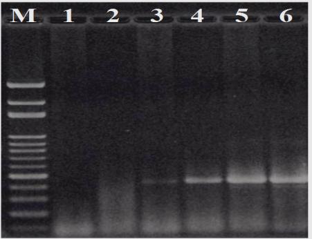 Figure 3: PCR detection of _Botryosphaeria rhodina_-specific DNA fragments with the genomic DNA’s extracted from surface-disinfected peanut kernels subjected to germination with artificial colonization with _Botryosphaeria rhodina_ RCYU 30101. M, 100-bp marker; 1, peanut kernels before germination (control); 2, peanut kernels after 2-d germination before artificial colonization; 3, 1-d further incubation after artificial colonization; 4, 2-d further incubation after artificial colonization; 5, 3-d further incubation after artificial colonization; 6, 4-d further incubation after artificial colonization.