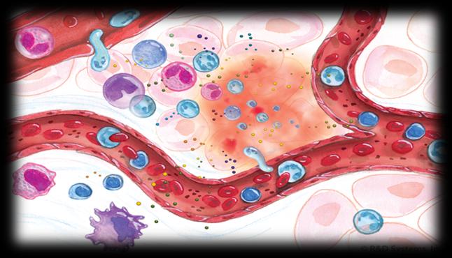 Figure 1: Inflammation is a complex response of biological cells to harmful stimuli or pathogens it involves both the immune system and local vasculature. http://www.medicalnewstoday.com/articles These harmful stimuli include damaged cell, pathogens, or irritants the body responds by inflammation of the tissue so inflammation is a normal response from the living tissues. It prepares the tissue for further healing and repairs [2].