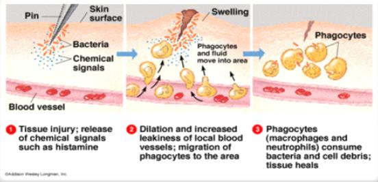 Figure 5: Steps of Inflammatory Process. http://www.medicalnewstoday.com/articles.php Inflammation helps in protection, by enclosing and isolating the injury. Then organisms and inactive toxins are invaded and destroyed. Consequently, healing and repair occur. Under ideal conditions the source of the tissue injury is eliminated, the inflammatory response resolves and normal tissue architecture and physiologic functions are restored. The nature of the acute inflammatory reaction is deep and the affected area is walled-off by the collection of inflammatory cells, this process results in destruction of tissue by products of polymorphonuclear leucocytes and formation of an abscess. Failure to eliminate the pathologic insult results in persistence of the inflammatory reaction. Chronic inflammation often leads to scar formation [31].