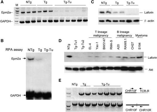 Figure 11: Schematic representation of the EPM2A gene expression pattern in normal and mutated states.