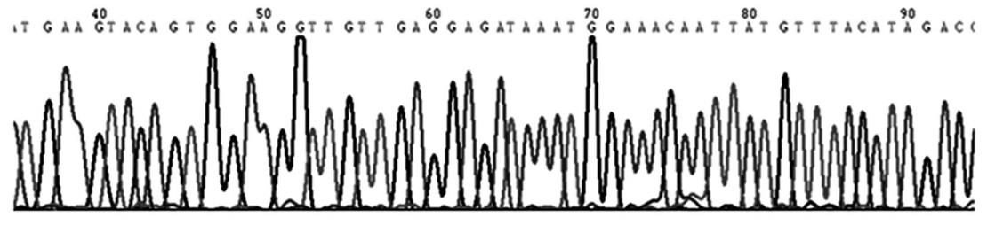 Figure 8: Schematic view of mutated CSF1R gene with nucleotide sequence change in patients with Adult-onset Leukoencephalopathy with Axonal Spheroids and Pigmented Glia Syndrome.