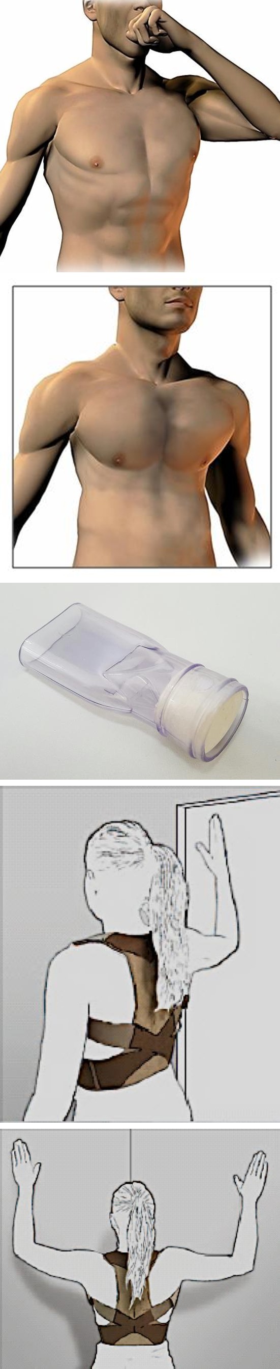 Figure 6: Example of one patient using PP in the post-operative period.