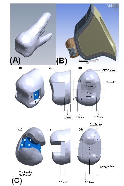 Figure 1: Geometry of the present model (A) cone beam image of the used maxillary first molar, (B) external surfaces of the present model and (C) geometry and dimensions of the cavity prepared for the modeled MOD composite restoration. The adhesive was, then, applied with a thickness of 45 µm, which is the smallest thickness that can be simulated in FEA. A resin composite was then used to fill the cavity and restore the original occlusal and proximal surfaces. The different parts of analyzed MOD restored tooth assembly are presented in (Figure 2A and B). The SolidWorks uses different file formats that can be exported to ANSYS 13.0 software (ANSYS Inc., Canonsburg, PA, USA). The IGES file format was invoked in the present work to export the geometries to the simulation software. ANSYS 13.0 software was employed to import the constructed tooth model. The mesial, distal and apical borders of the model were fixed with no separation allowed at the contact surfaces of the parts of the assembly. The software generated a computational mesh; mesh trials were first performed for the convergence of the total elastic strain energy to achieve the final analyzed model shown in (Figure 2C). The number of the nodal points and tetrahedral elements of the zones of the model are listed in (Table 2). The mucosa and the periodontal ligament were considered as a continuous body as in reality. The materials of the model zones of the tooth were assumed to be isotropic homogenous and linearly elastic.