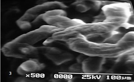 Figure 3: Mature intermediate villi shows a cell surface wrinkled.