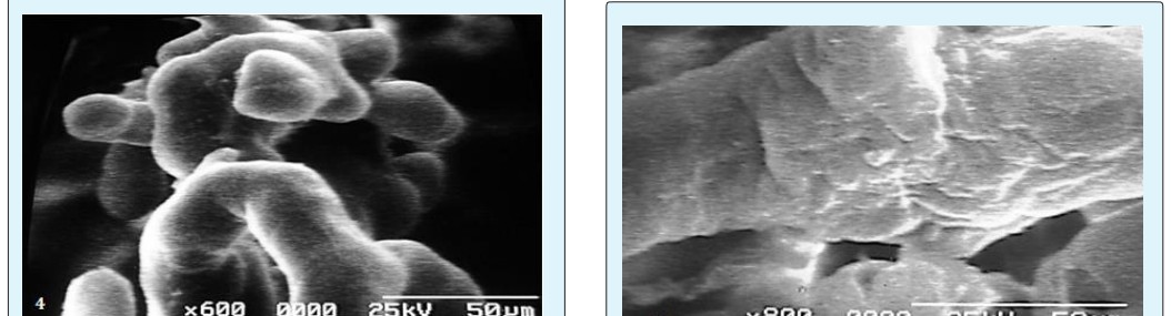 Figure 5: Immature villi exhibits collapsed globular extensions.