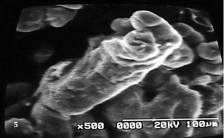 Figure 6: The arrow indicates a fracture of the syncytial membrane in immature villi.
