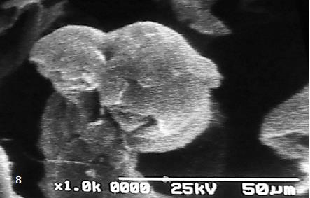 Figure 7: Immature intermediate villi present a scalloped surface.