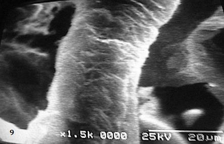 Figure 8: Immature villi show irregular microvilli on the cell surface.