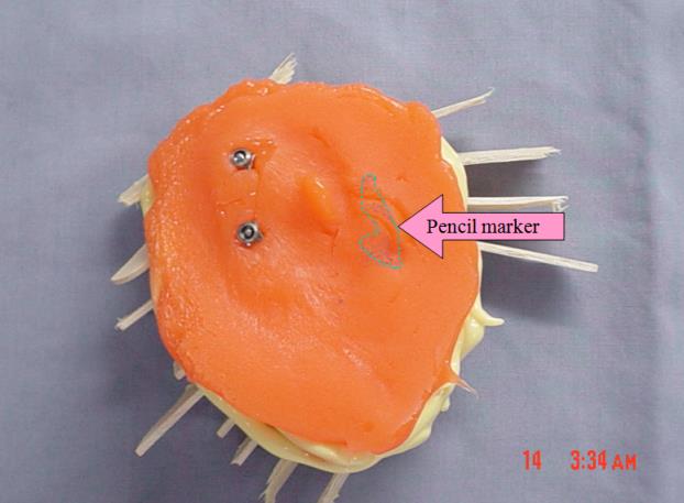 Figure 5: Tissue surface of impression with pencil marker.