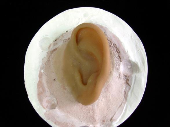 Figure 7: Definitive prothesis on the master cast.