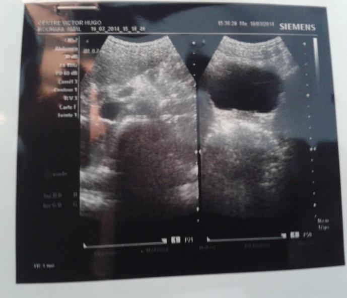 Figure 2: Abdominal US.