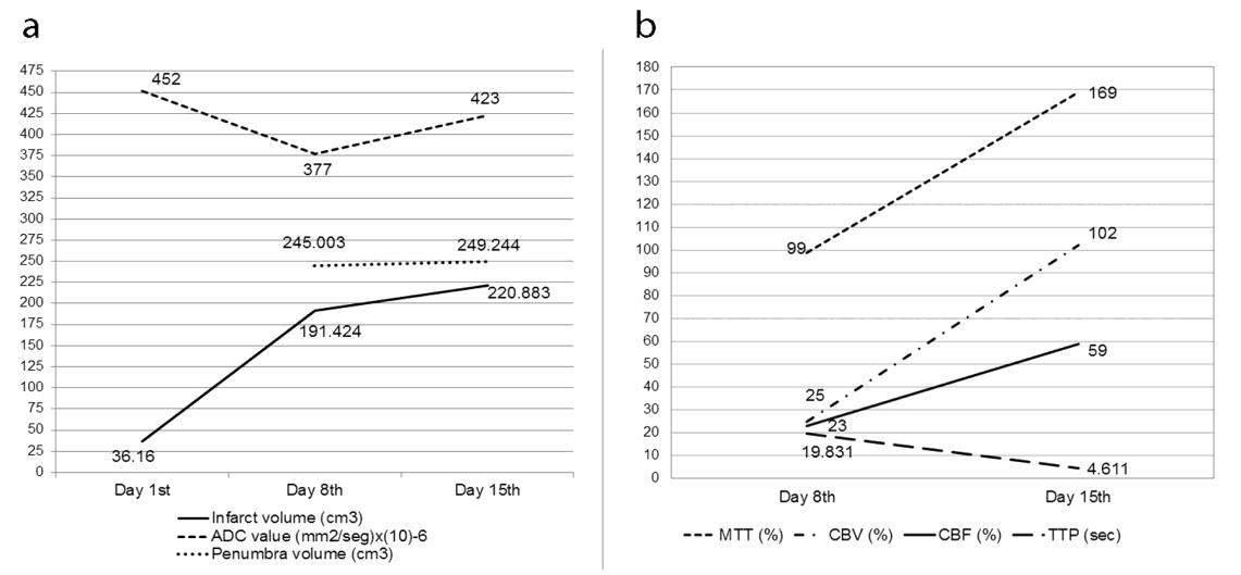 Figure 3: Line graphs show the evolution of diffusion and perfusion measures. A, theprogression of ADC values, infarct and penumbra volumes measured in cm3. B, perfusion parameters of the 2nd and 3rd brain MRI, showing the increase in MTT, CBV, and CBF and decrease in the TTP (delay of contrast arrival measured in seconds).