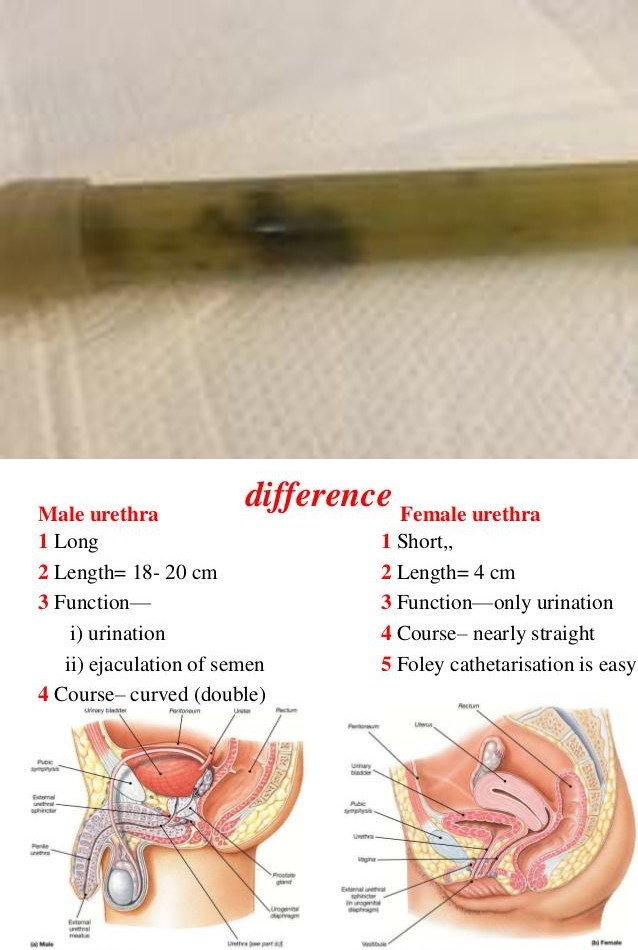 Figure 2: The black, hard pieces of gravel in the tube.