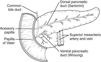 Figure 1: Diagrammatic Representation of Pancreas Divisum.