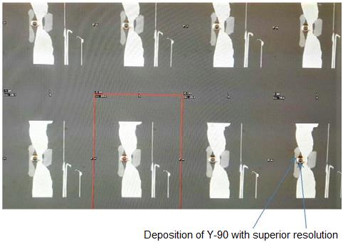 Figure 6: A selected PET/CT sagittal images of the in- house phantom and the embedded 90Y.