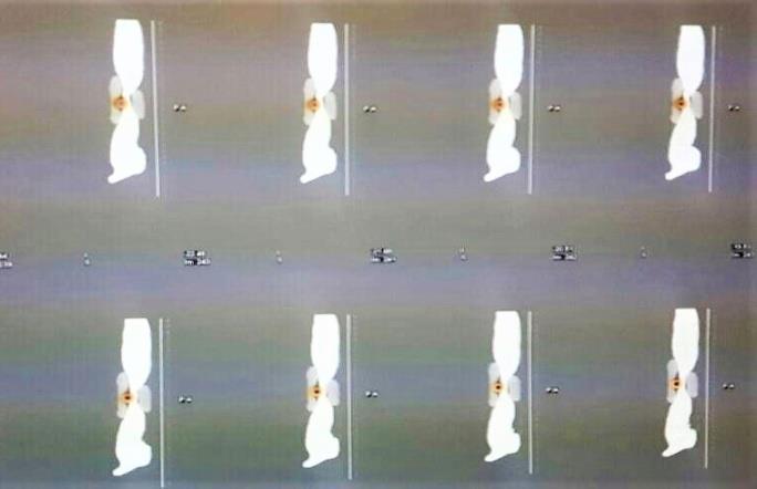 Figure 7: A selected SPECT/CT sagittal images of the in-house phantom and the embedded 90Y.