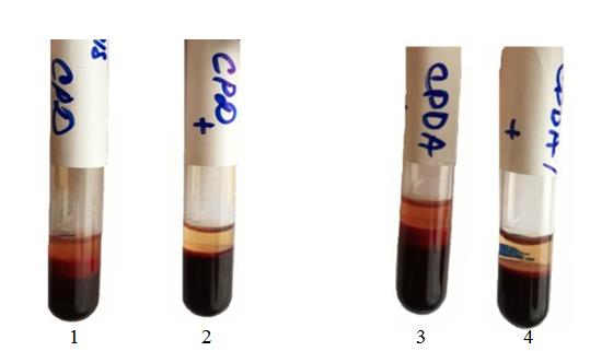 Figure 5: product of glycolysis. The sedimentation stability of RBC is determined by the amount of ATP.