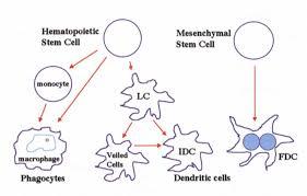 Figure 3: Follicular Dendritic Cell Sarcoma with pleomorphic cells.