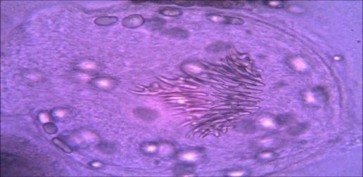 Figure 5: Shows the viable protoscoleces and hook let stain by staining with an aqueous solution of 0.1% eosin.