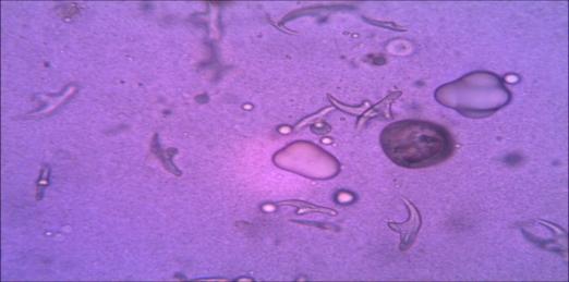 Figure 6: shows the viable hook let stain by staining with an aqueous solution of 0.1% eosin.